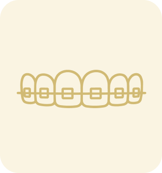 ワイヤー矯正（小児）