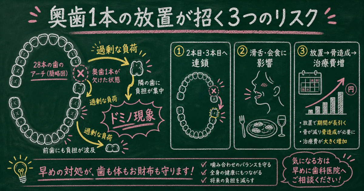 「奥歯1本なら問題ない」は誤解——放置しがちな人が見落とす3つの事実