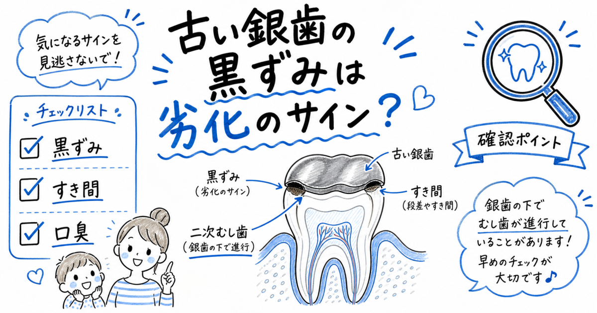 古い銀歯の黒ずみは劣化のサイン?放置リスクと痛くない二次むし歯