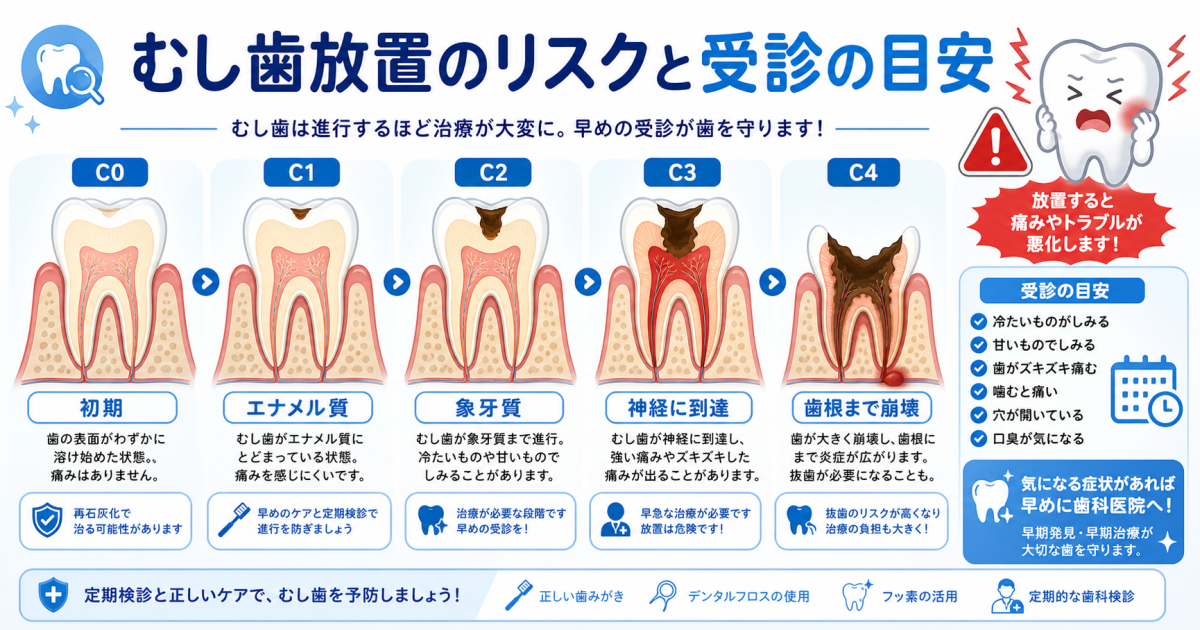 むし歯を放置するリスクとは？早めの受診が大切な理由