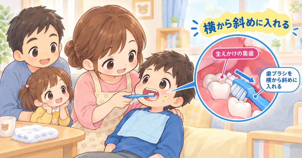 生え変わり時期のむし歯予防:仕上げみがき・フッ化物・歯科で確認する目安
