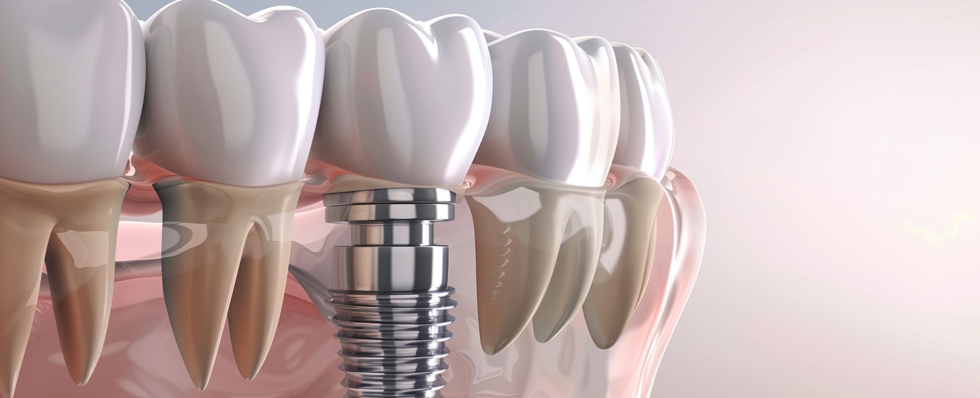 子どもの矯正（小児矯正）とは？