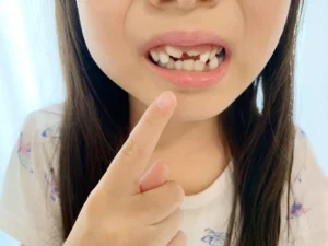 子どもの歯の生え変わりはいつから？順番や注意点を歯科医院が解説