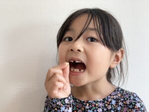 子どもの乳歯に隙間があるけど大丈夫？実は「ない方」が危険な理由