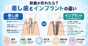 前歯が折れたら？差し歯とインプラントの違いと失敗しない5つの基準