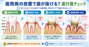40代男性向け！歯周病の放置で歯が抜ける？リスクと進行度チェック