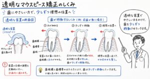 透明な装置でなぜ動く？マウスピース矯正の仕組みと治療の流れ